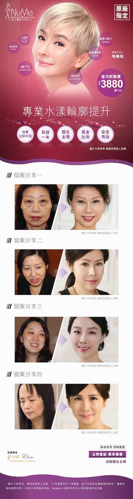 20160926_Juvederm_輪廓塑形_mobile 拷貝.jpg
